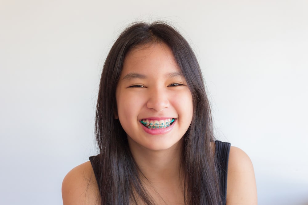 Asian,Girl,Has,Braces,And,She,Smile,Happily