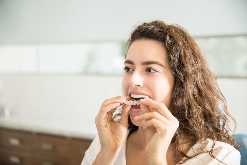 Closeup,Of,Beautiful,Young,Woman,Wearing,Clear,Aligner,In,Dental