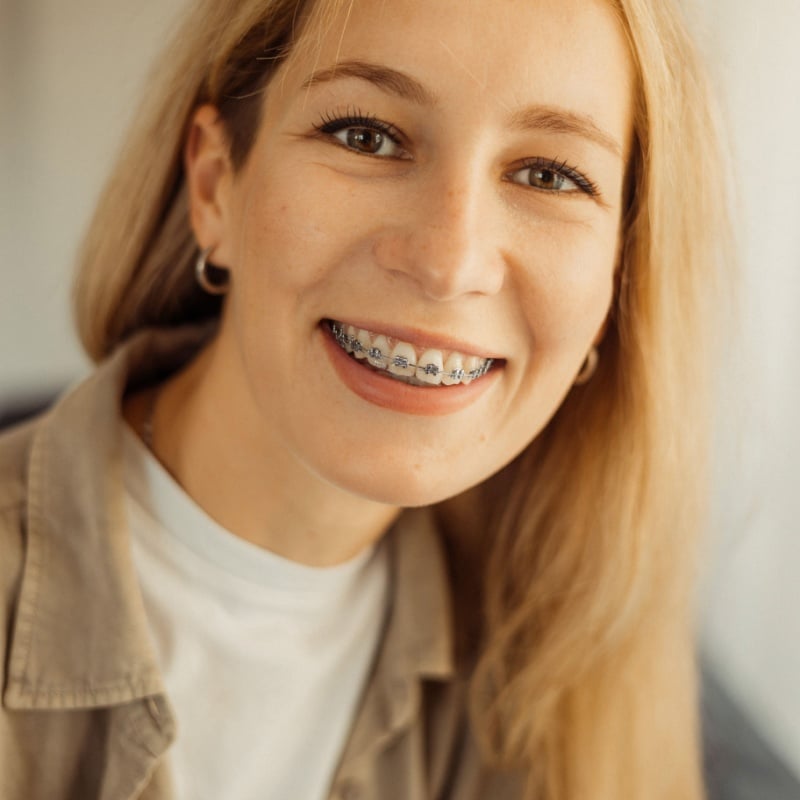 Traditional Metal Braces in Lufkin and Nacogdoches, Clear Ceramic Braces in Lufkin and Nacogdoches