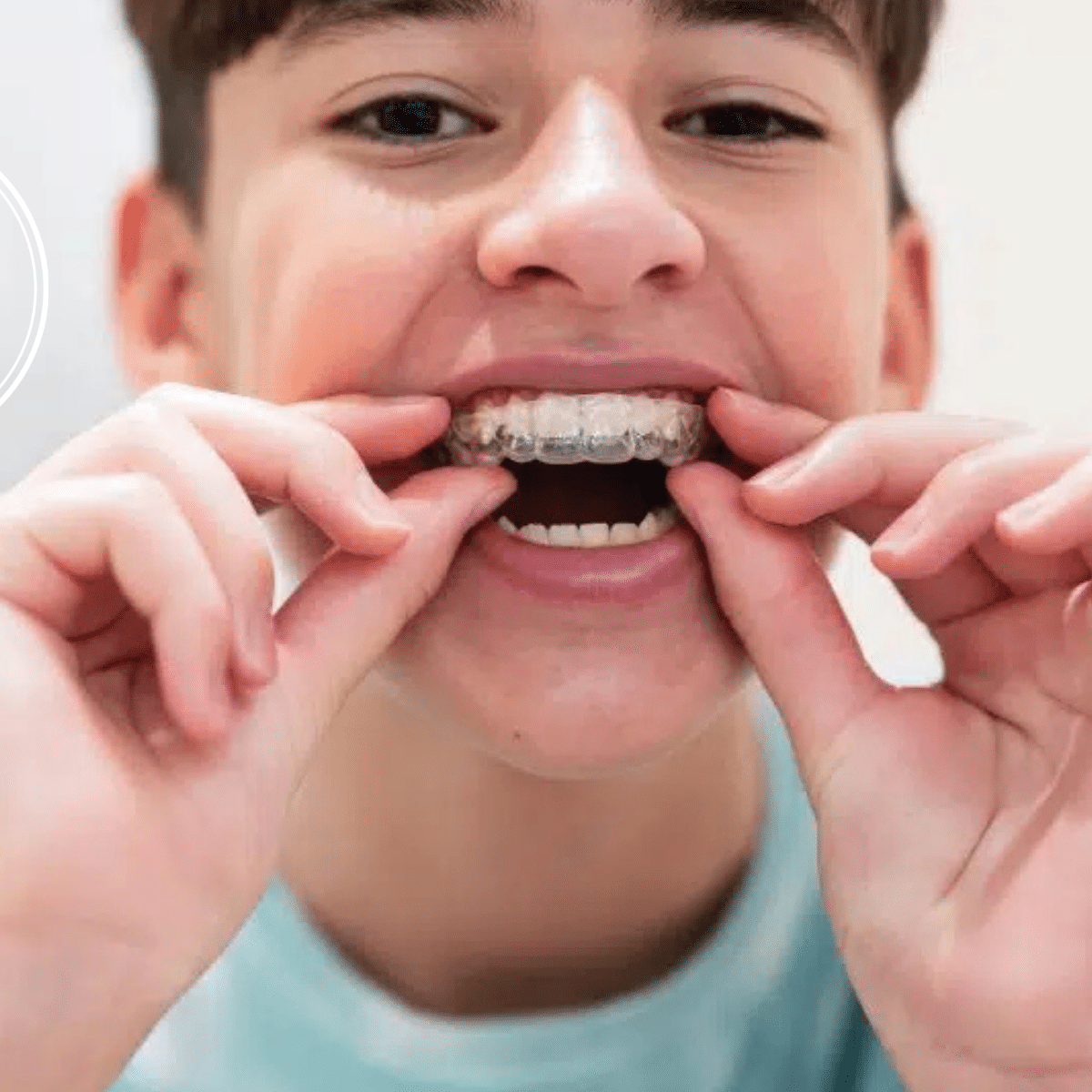 Invisalign