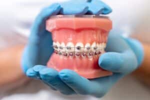 Interceptive Orthodontics Nacogdoches