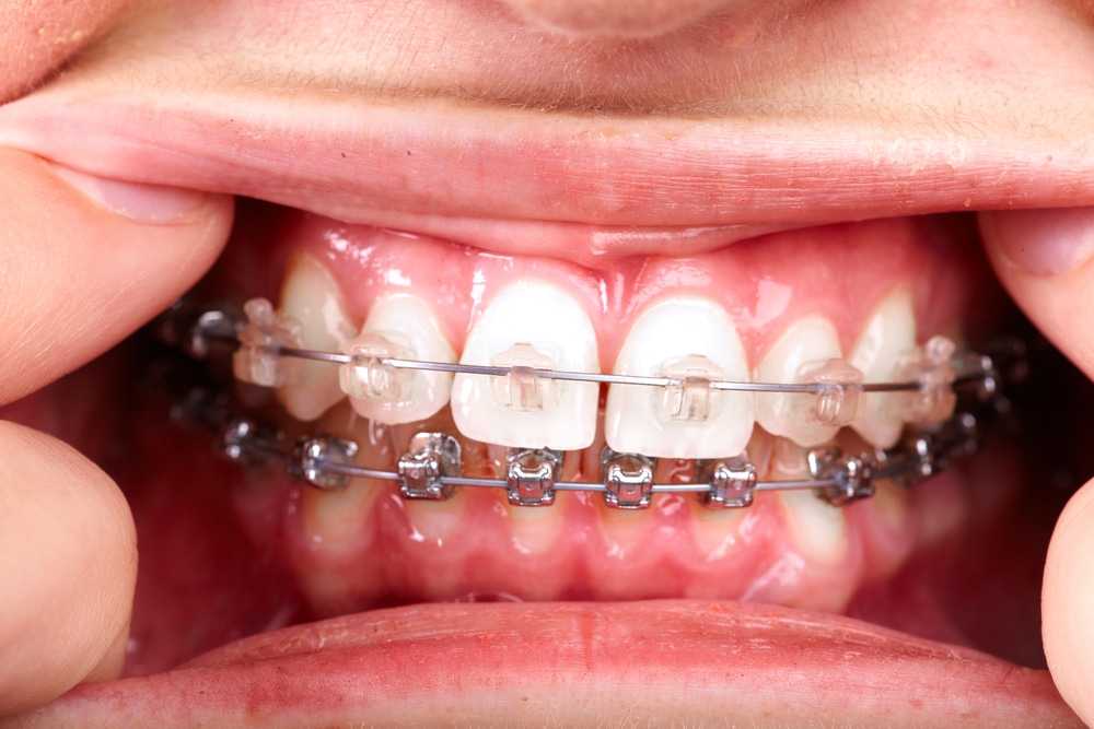 The Art and Science of Dentofacial Orthopedics in Lufkin