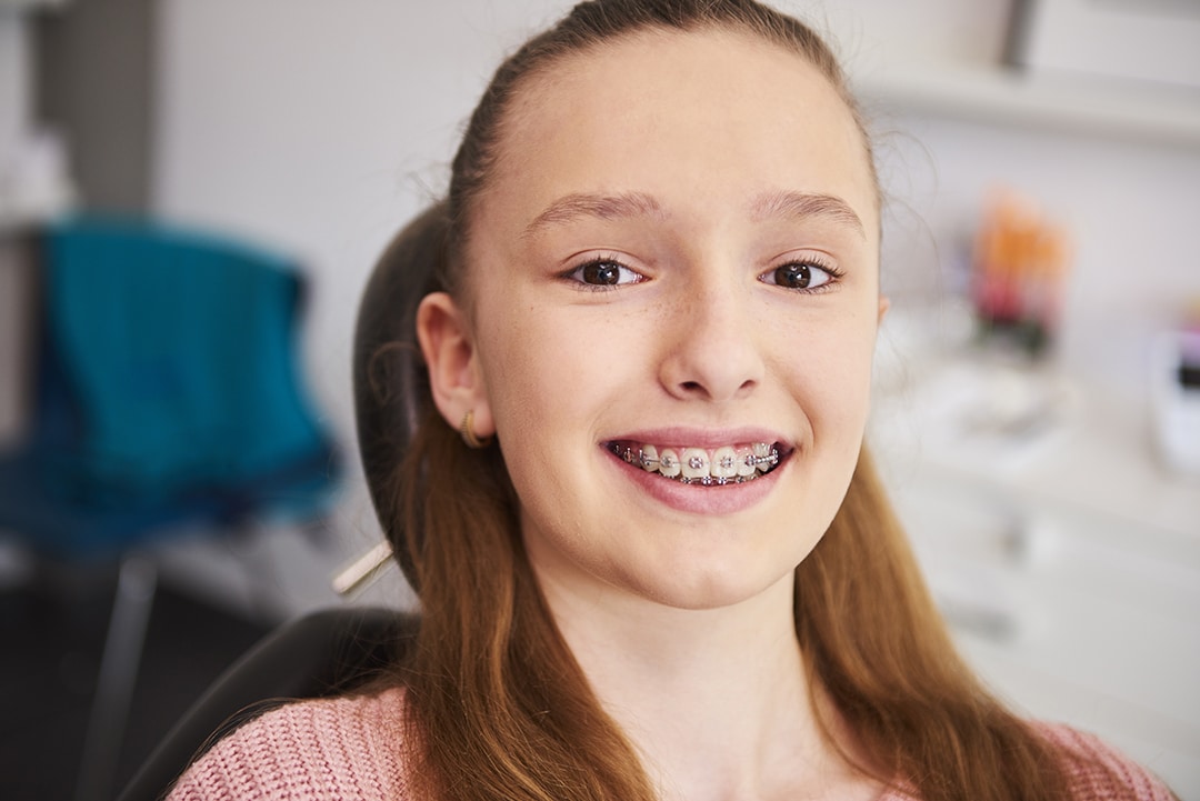 Braces for Teens in Lufkin: A Confident Choice for Growing Smiles