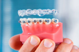 Orthodontic Adjustments in Lufkin